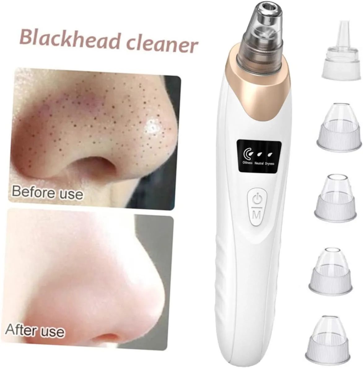 Electric Blackhead Remover Vacuum | Face Vacuum Pore Cleanser-5 Suction Probes